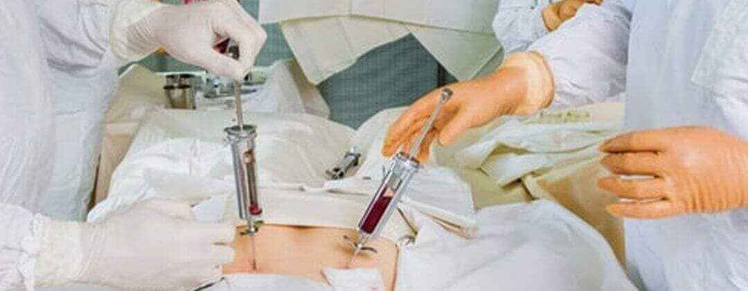 top bone marrow transplant hospitals Hyderabad | bmt Cancer Treatment