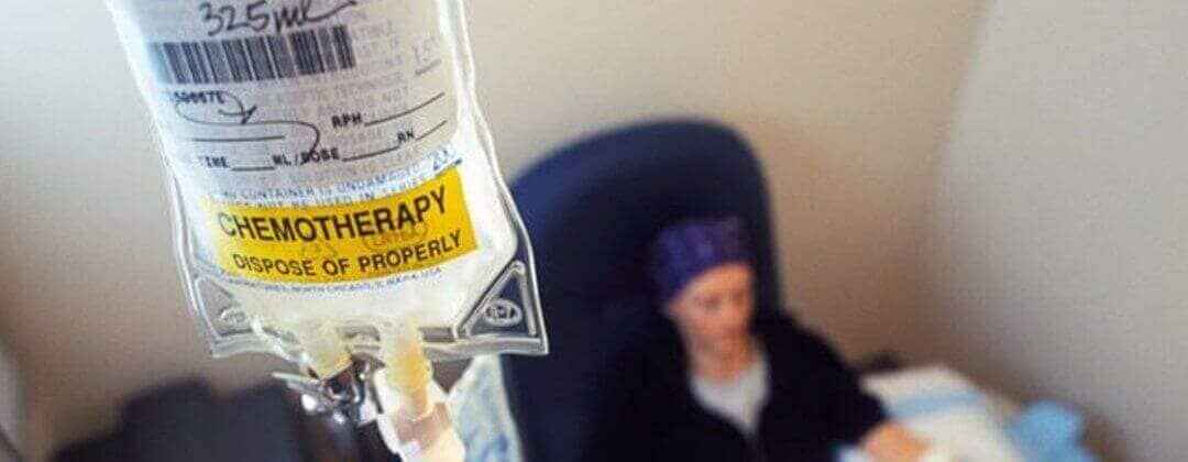 Best doctor for Chemotherapy in Hyderabad